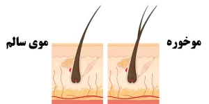 موخوره چیست ادز بیوتی